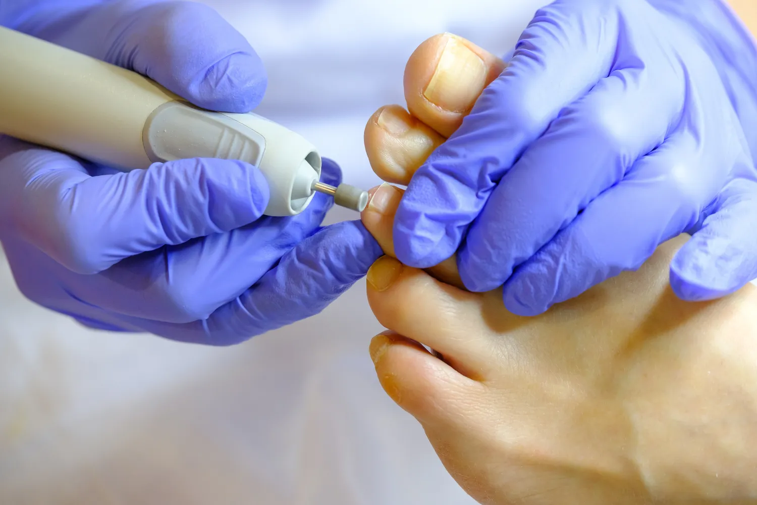 Pedicure leczniczy - co na ten temat wiedzieć trzeba?