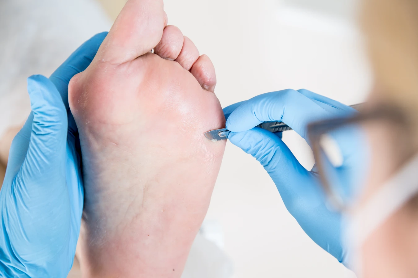 Pedicure podologiczne Warszawa